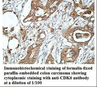 Polyclonal Rabbit anti-Human CDK6 Antibody (aa155-301, IHC, WB)
