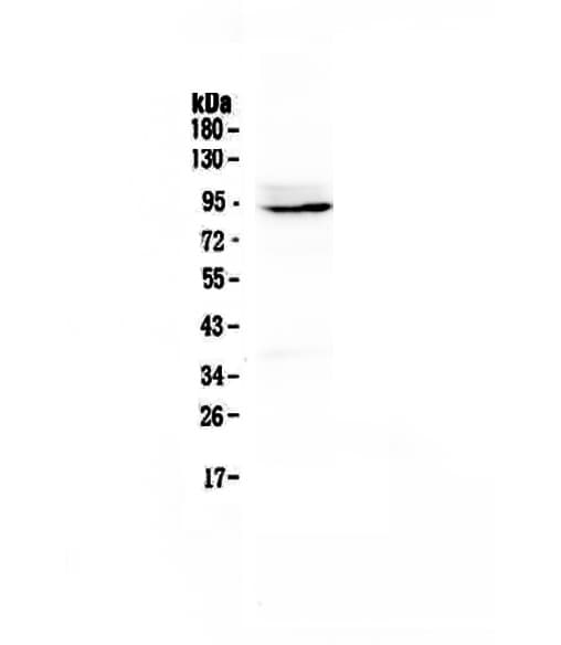 Polyclonal Rabbit anti-Mouse PTPN22 / PEP Antibody (IHC, WB)