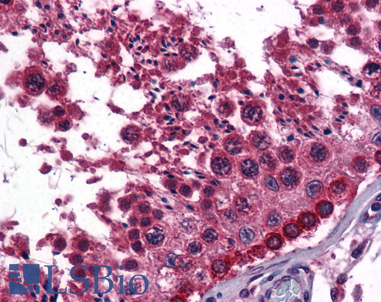 IHC-plus™ Monoclonal Mouse anti-Human EGF Antibody (clone 9D7F11, IHC, WB)