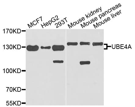 Polyclonal Rabbit anti-Human E4 / UBE4A Antibody (WB)