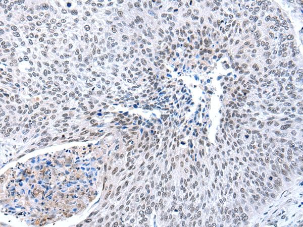 Polyclonal Rabbit anti-Human MORC2 Antibody (IHC, WB)