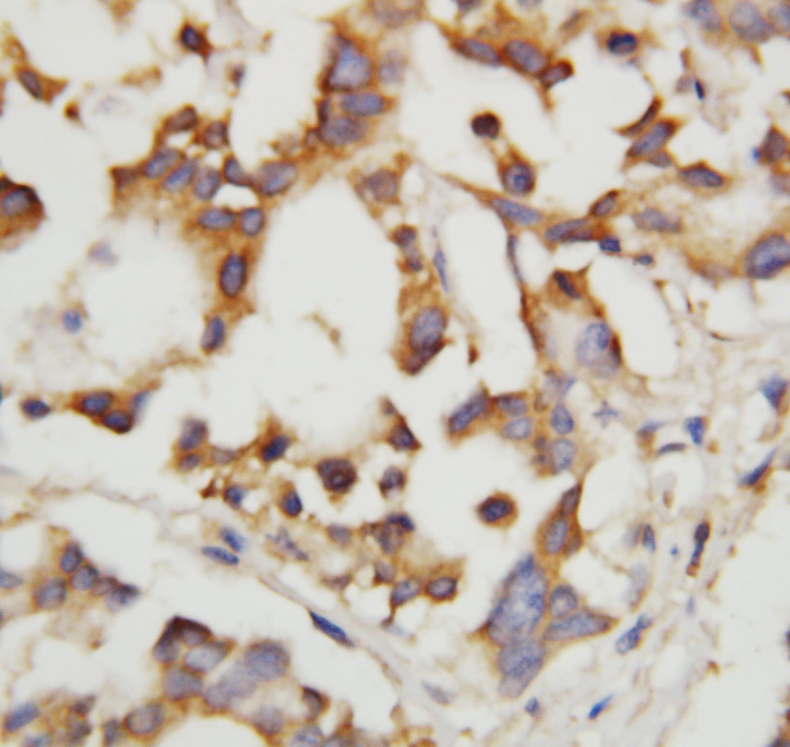 CTH / Cystathionase Antibody (aa316-331)