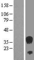 SEC13 Protein (Over-Expression Lysate Myc-DDK (Flag))