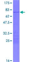 Human VSX2 / CHX10 Protein (Recombinant GST)