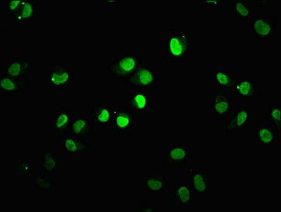 Polyclonal Rabbit anti-Human HIST1H1E Antibody (IHC)