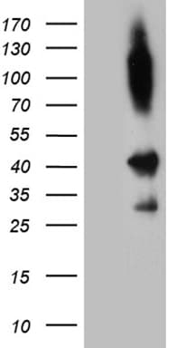 SHARPIN Antibody (aa1-326, clone OTI1D11)