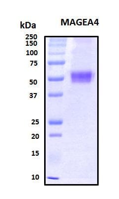 Human MAGEA4 Protein (Recombinant His, N-Terminal)