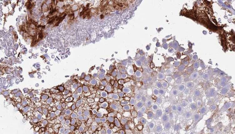 AGER / RAGE Antibody