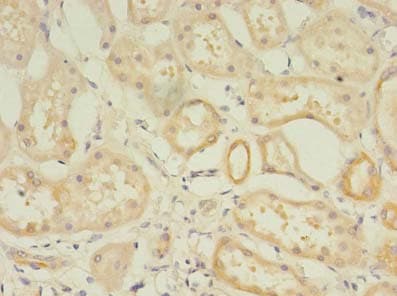 RPGR Antibody