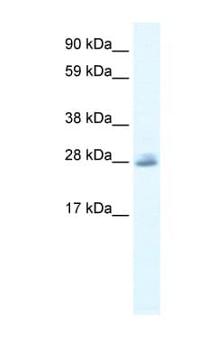 CLIC5 Antibody (C-Terminus)