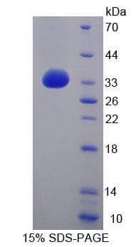 Rat ABCG8 Protein (Recombinant His-T7, N-terminus)