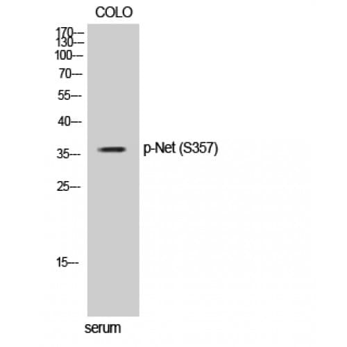 ELK3 / NET Antibody (300-380 aa)