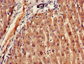Polyclonal Rabbit anti-Human FADS1 Antibody (IHC, IF)