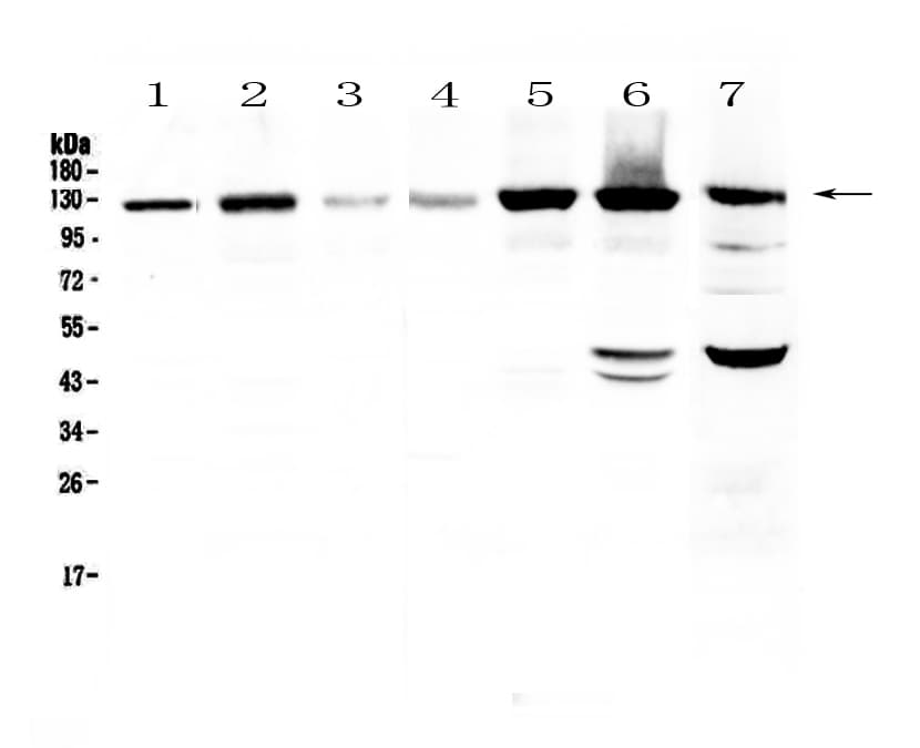 EPHA2 / EPH Receptor A2 Antibody
