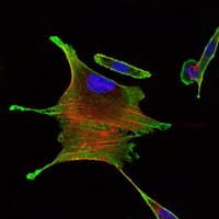 IHC-plus™ Monoclonal Mouse anti-Human BMPR2 Antibody (clone 3F6, IHC, IF, WB)