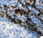 Monoclonal Mouse anti-Human CD34 Antibody (clone QBEnd/10, Ready-to-Use, IHC)