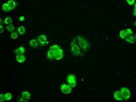 AK1 / Adenylate Kinase 1 Antibody (clone OTI19D1)