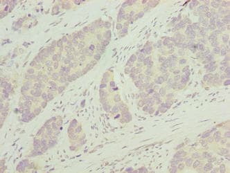 PLEKHJ1 Antibody