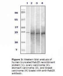 Monoclonal Mouse anti-Human RAB25 Antibody (clone 3F12F3, IHC, WB)