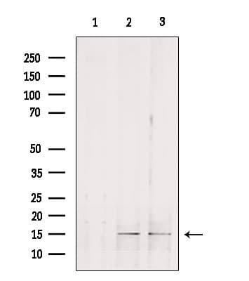 GOLT1B Antibody