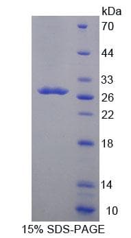 Human ACADL Protein (Recombinant His-T7, N-terminus)