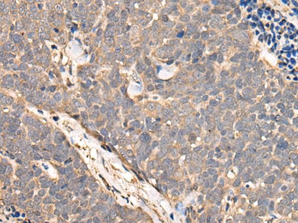 NCAPH / CAP-H Antibody