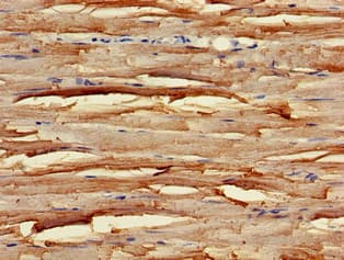 Polyclonal Rabbit anti-Human UNC45B Antibody (IHC)