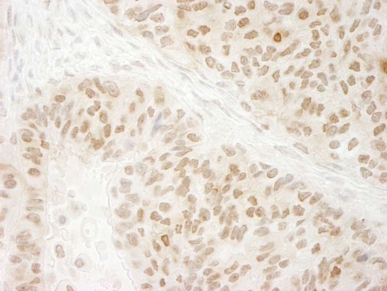 Polyclonal Rabbit anti-Human EHMT2 / G9A Antibody (aa1160-C-term, IHC)