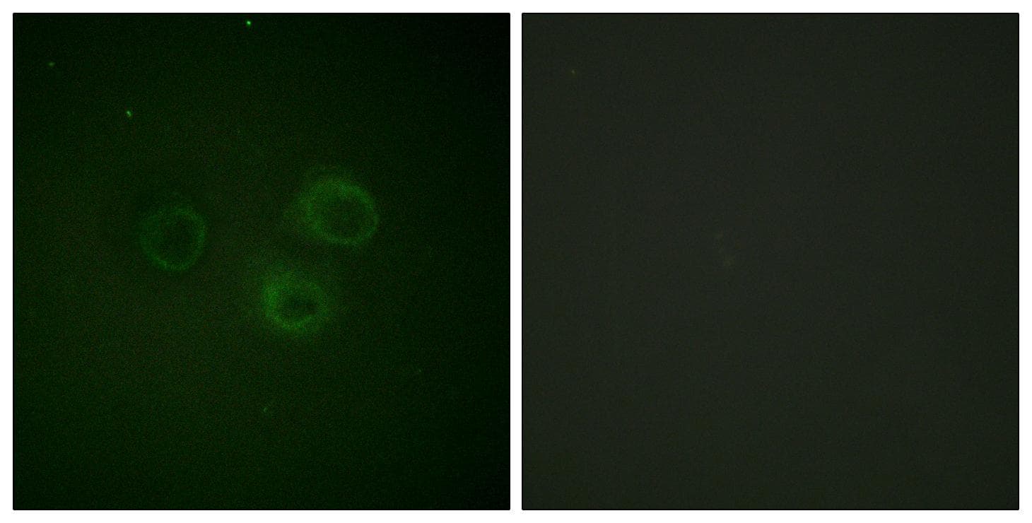 DNAM-1 / CD226 Antibody (phospho-Ser329)