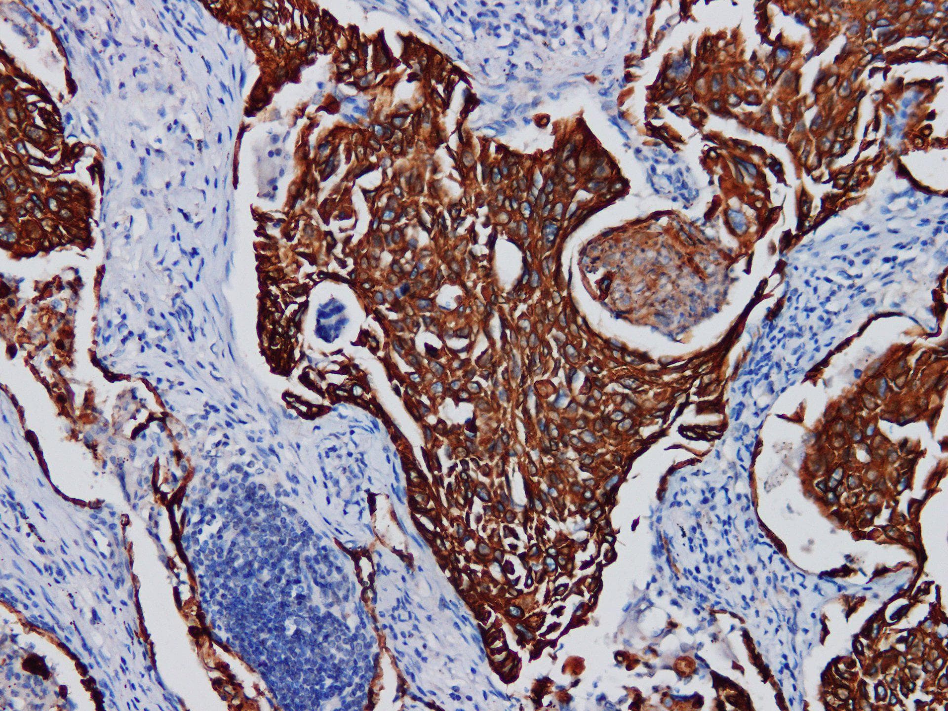 Pan Cytokeratin Antibody