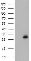 NQO2 Antibody (clone OTI4B2)