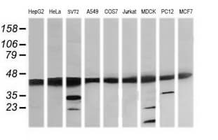 MAP2K1 / MKK1 / MEK1 Antibody (clone OTI2B7)