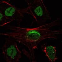 SIRT1 / Sirtuin 1 Antibody (clone 1F3)