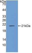 PHAP1 / ANP32A Antibody (aa2-249)