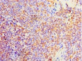 PVALB / Parvalbumin Antibody (aa2-110)