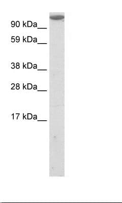 BSAC / MKL1 Antibody (aa721-770)
