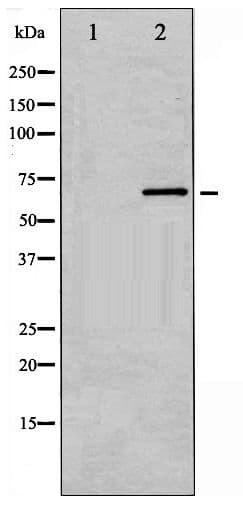 PRKCB / PKC-Beta Antibody (phospho-Ser661)