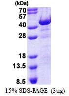 Human HHEX / HEX Protein (Recombinant His)