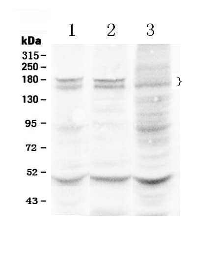 THBS1 / Thrombospondin-1 Antibody