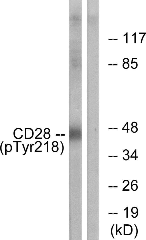 CD28 Antibody (phospho-Tyr218)