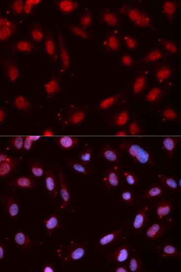 CHEK1 / CHK1 Antibody (phospho-Ser280)