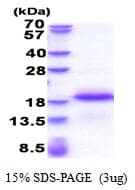 Human EAF1 / ELL Associated Factor 1 Protein (Recombinant His)