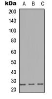 Polyclonal Rabbit anti-Human IGLL1 / CD179b Antibody (C-Terminus, WB)