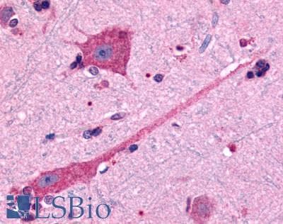 IHC-plus™ DRD2 / Dopamine Receptor D2 Antibody (Cytoplasmic Domain)
