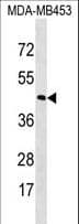 Polyclonal Rabbit anti-Human Rhodopsin / RHO Antibody (aa310-339, WB)