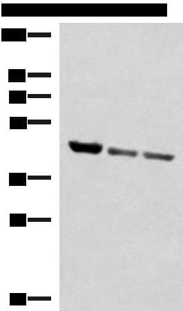 SCCPDH Antibody