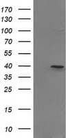 PIH1D2 Antibody (clone OTI5G9)