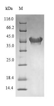 Escherichia coli fabB Protein (Recombinant 6His, N-terminus + Myc, C-terminus)