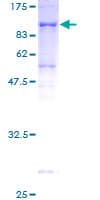 Human AK5 / Adenylate Kinase 5 Protein (Recombinant GST)