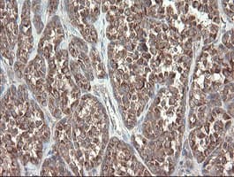 DPH2 Antibody (clone OTI2B12)